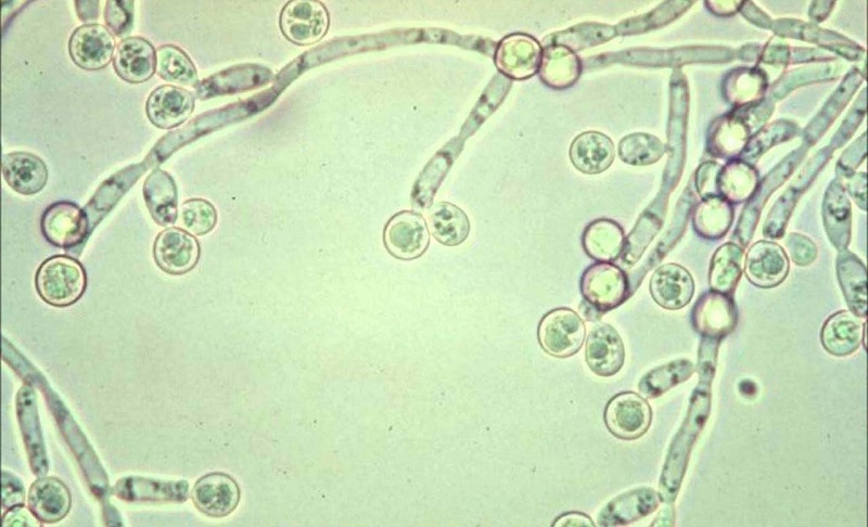 Nấm candida albican là nguyên nhân chính gây nấm miệng